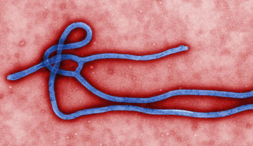 警惕最新病毒病人，你需要了解這些關(guān)鍵信息！