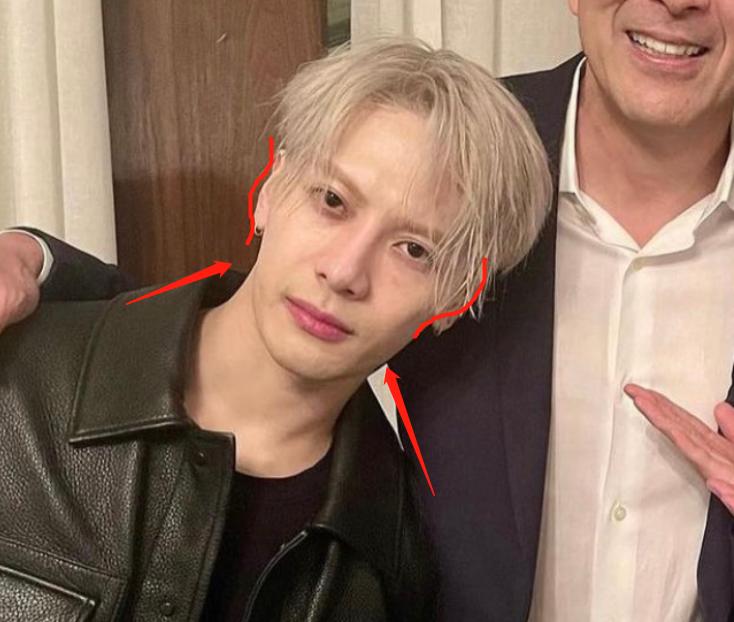 深度解析明星整容后遺癥，觀點與影響探討