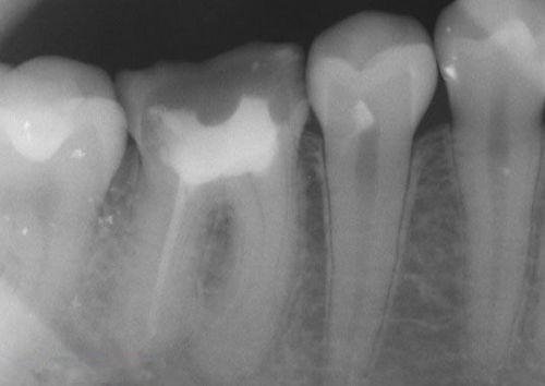 中國再生牙齒研究新進(jìn)展，重塑微笑，科技引領(lǐng)牙齒再生新篇章