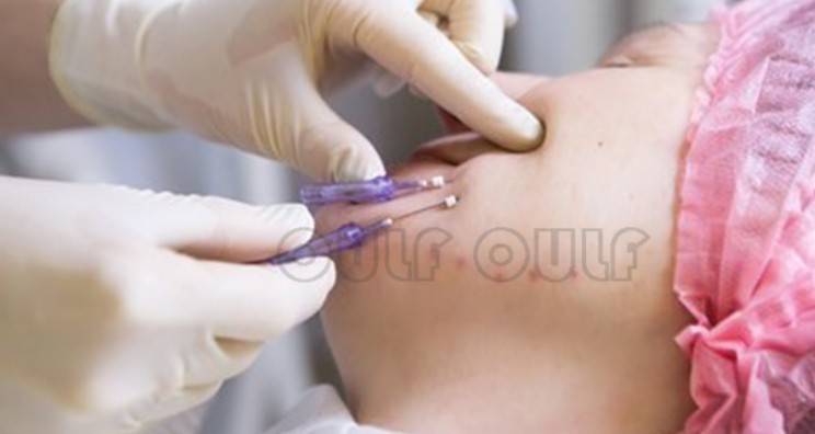 線雕最新手法，背景、發(fā)展、時代地位及展望